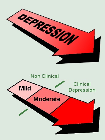 Types of depression diagram